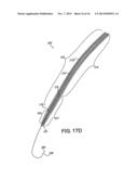 TRANSSEPTAL GUIDEWIRE diagram and image