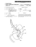 INTRAGASTRIC SPACE FILLER diagram and image