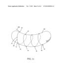 INTRAGASTRIC SPACE FILLER diagram and image