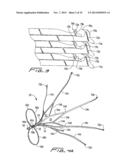 VEIN FILTER diagram and image