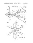 VEIN FILTER diagram and image