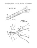 VEIN FILTER diagram and image