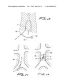 VEIN FILTER diagram and image