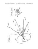 VEIN FILTER diagram and image