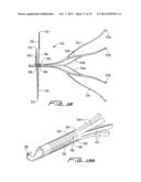 VEIN FILTER diagram and image