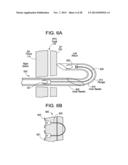 PATENT FORAMEN OVALE CLOSURE DEVICE diagram and image