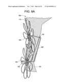 PATENT FORAMEN OVALE CLOSURE DEVICE diagram and image