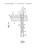 PATENT FORAMEN OVALE CLOSURE DEVICE diagram and image