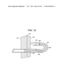 PATENT FORAMEN OVALE CLOSURE DEVICE diagram and image