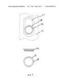 ADJUSTABLE SPINOUS PROCESS SPACER DEVICE AND METHOD OF TREATING SPINAL     DISORDERS diagram and image