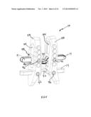 ADJUSTABLE SPINOUS PROCESS SPACER DEVICE AND METHOD OF TREATING SPINAL     DISORDERS diagram and image