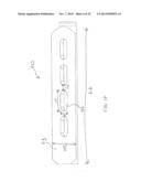 FENESTRATED IMPLANT diagram and image