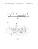 EXPANDABLE FIXATION MECHANISM diagram and image