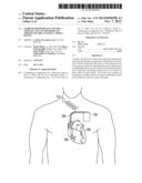 COMBINED REMODELING CONTROL THERAPY AND ANTI-REMODELING THERAPY BY     IMPLANTABLE CARDIAC DEVICE diagram and image