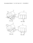 INDEPENDENTLY ADJUSTABLE SUPPORT SYSTEM diagram and image