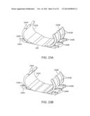 INDEPENDENTLY ADJUSTABLE SUPPORT SYSTEM diagram and image