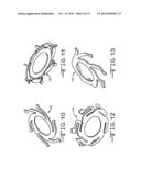 VEHICLE DISC BRAKE ASSEMBLY HAVING A MECHANICALLY ACTUATED PARKING BRAKE diagram and image