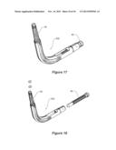 SUPPORT ARRANGEMENT FOR AN IMPLEMENT diagram and image