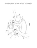 MOUNTING SYSTEM AND METHODS FOR ATTACHING ACCESSORY COMPONENTS diagram and image