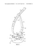 MOUNTING SYSTEM AND METHODS FOR ATTACHING ACCESSORY COMPONENTS diagram and image