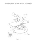 MOUNTING SYSTEM AND METHODS FOR ATTACHING ACCESSORY COMPONENTS diagram and image