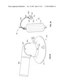 MOUNTING SYSTEM AND METHODS FOR ATTACHING ACCESSORY COMPONENTS diagram and image