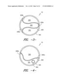 DIVIDED CONDUIT EXTRUSION DIE AND METHOD WITH JOINING FEATURES diagram and image