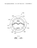 DIVIDED CONDUIT EXTRUSION DIE AND METHOD WITH JOINING FEATURES diagram and image