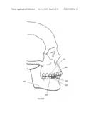 Jaw Powered Electric Generator diagram and image