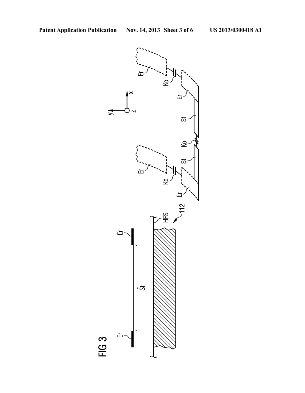 MR Antenna With Compensation for Variable Distance to Shield - diagram, schematic, and image 04