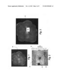 Multimodality correlation of optical coherence tomography using secondary     reference images diagram and image