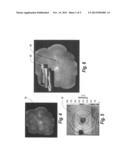 Multimodality correlation of optical coherence tomography using secondary     reference images diagram and image