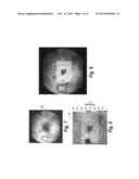 Multimodality correlation of optical coherence tomography using secondary     reference images diagram and image