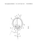 ORTHOVOLTAGE RADIOTHERAPY diagram and image