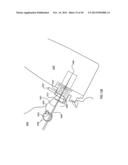 ORTHOVOLTAGE RADIOTHERAPY diagram and image