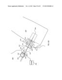 ORTHOVOLTAGE RADIOTHERAPY diagram and image