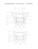 Acoustic Device diagram and image