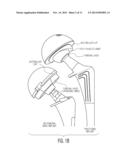 Metallic Object MR Imaging Quality Control System diagram and image