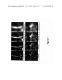 METHOD OF DEFORMABLE MOTION CORRECTION AND IMAGE REGISTRATION IN X-RAY     STENT IMAGING diagram and image