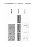 METHOD OF DEFORMABLE MOTION CORRECTION AND IMAGE REGISTRATION IN X-RAY     STENT IMAGING diagram and image