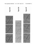 METHOD OF DEFORMABLE MOTION CORRECTION AND IMAGE REGISTRATION IN X-RAY     STENT IMAGING diagram and image