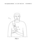 CAMERA CARRYING DEVICE WITH LOCKING MECHANISM diagram and image