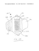 CAMERA CARRYING DEVICE WITH LOCKING MECHANISM diagram and image