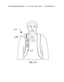 CAMERA CARRYING DEVICE WITH LOCKING MECHANISM diagram and image