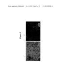 Modalities for the treatment of degenerative diseases of the retina diagram and image