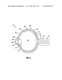 Methods for treating retinopathy with extended therapeutic effect diagram and image