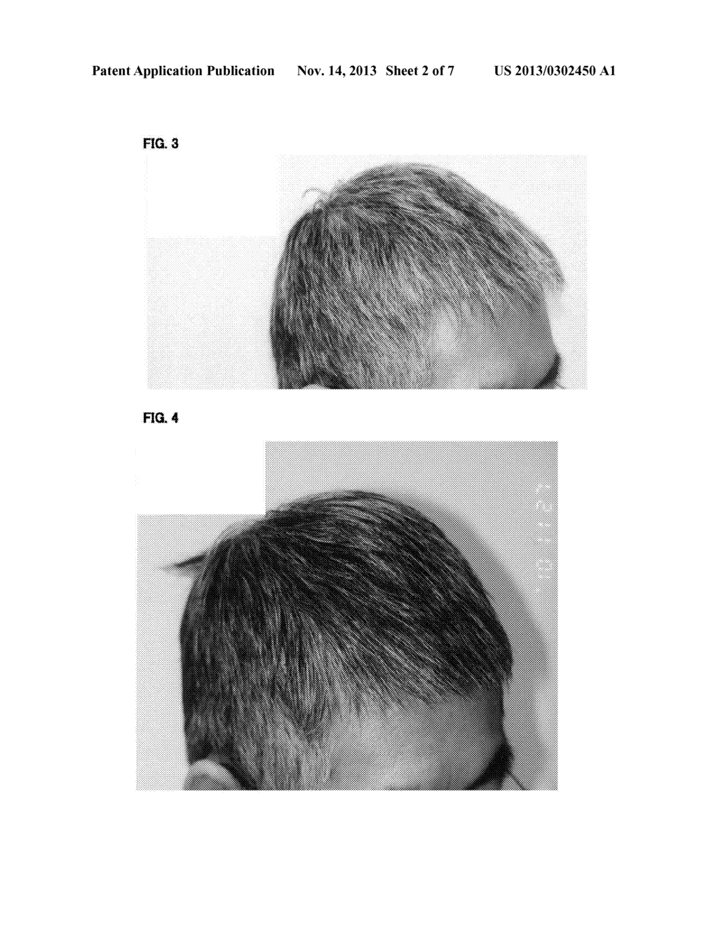 HAIR GROWTH AND FOSTERING AGENT - diagram, schematic, and image 03