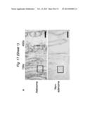 THERAPEUTIC APPLICATIONS OF P53 ISOFORMS IN REGENERATIVE MEDICINE, AGING     AND CANCER diagram and image