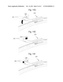 PERCUTANEOUS POWER DELIVERY SYSTEM FOR PERMANENTLY IMPLANTED MEDICAL     DEVICES AND MANUFACTURING METHOD diagram and image