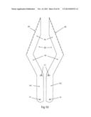 Slingblade Broad-head Delivery System diagram and image